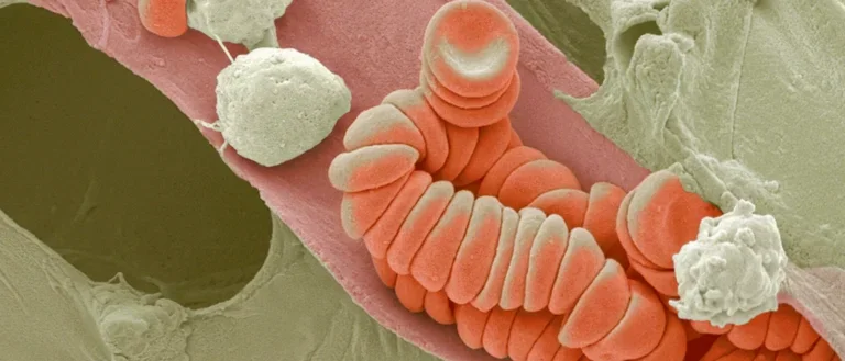 Cross-section of a blood vessel showing a clot in different cells that make up the clot.