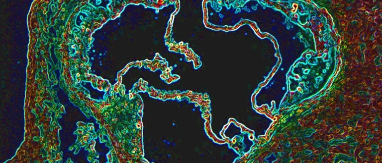 Cross section of the aorta. It shows heart disease block in green.